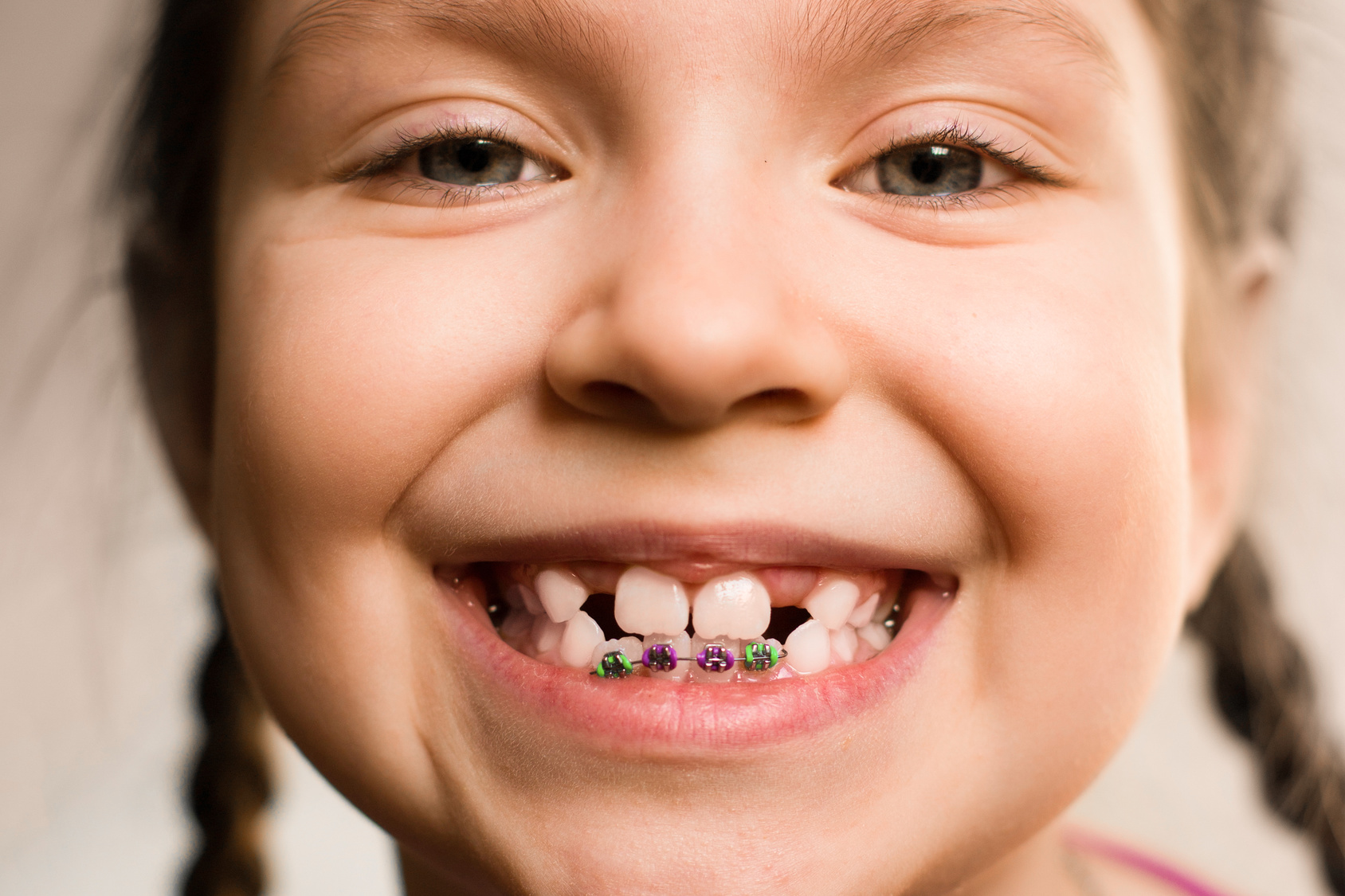 Dziezko z aparatem ortodontycznym