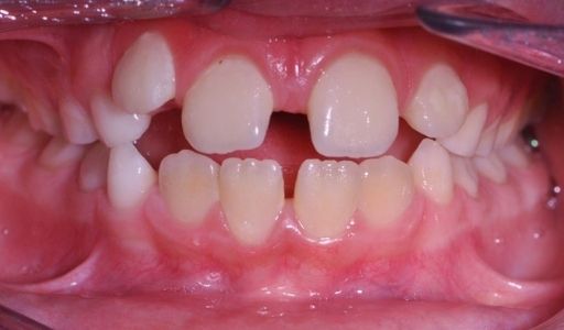 Ortodoncja Odent s1.1