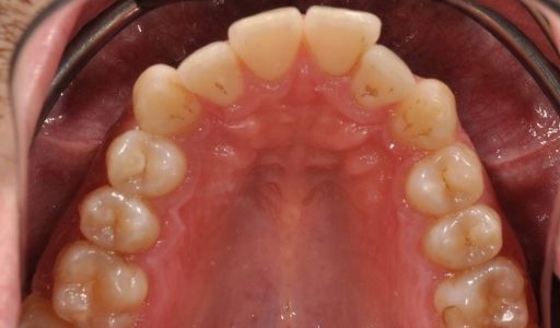 Ortodoncja Odent s10.1