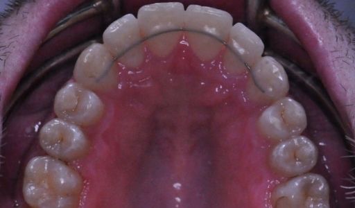 Ortodoncja Odent s10.2