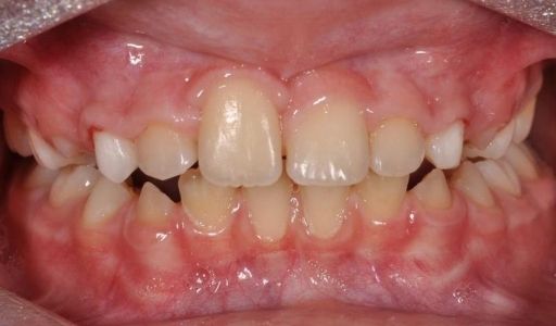 Ortodoncja Odent s11.2