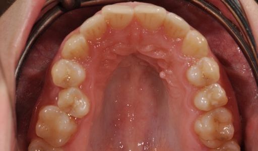 Ortodoncja Odent s12.1