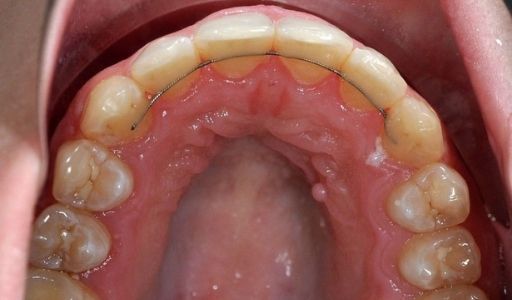 Ortodoncja Odent s12.2
