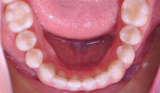 Ortodoncja Odent s16.2
