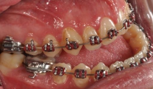 Ortodoncja Odent s2.1