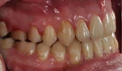 Ortodoncja Odent s2.2