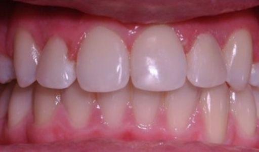 Ortodoncja Odent s4.2