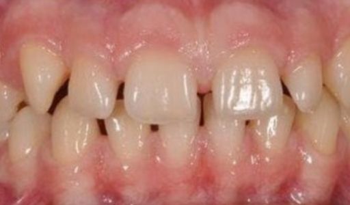 Ortodoncja Odent s5.1