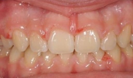 Ortodoncja Odent s5.2