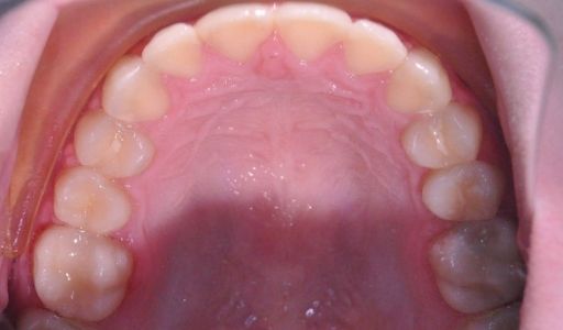 Ortodoncja Odent s6.2