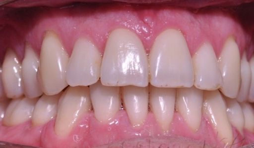 Ortodoncja Odent s7.2