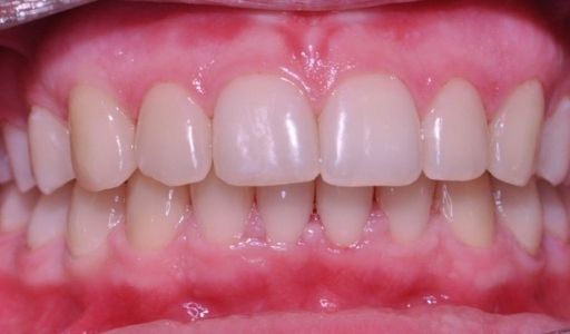 Ortodoncja Odent s9.2