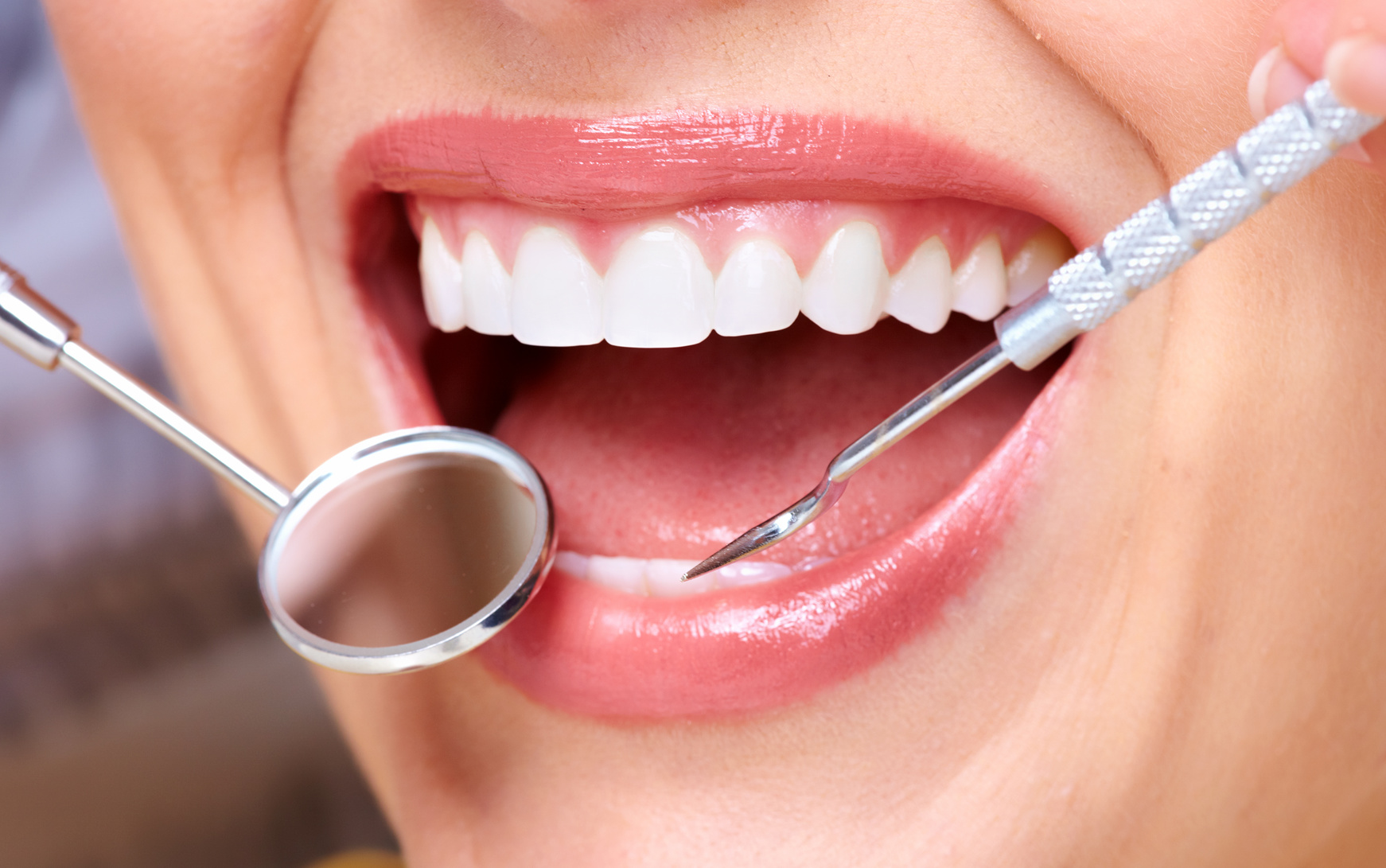Cavities of non-carious origin