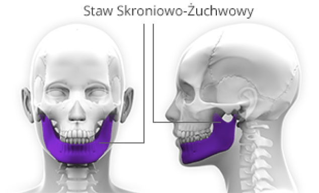 Leczenie stawu skroniowo żuchwowego 