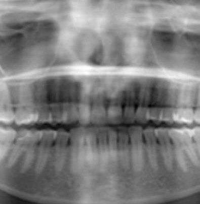 Pracownia rtg dentysta