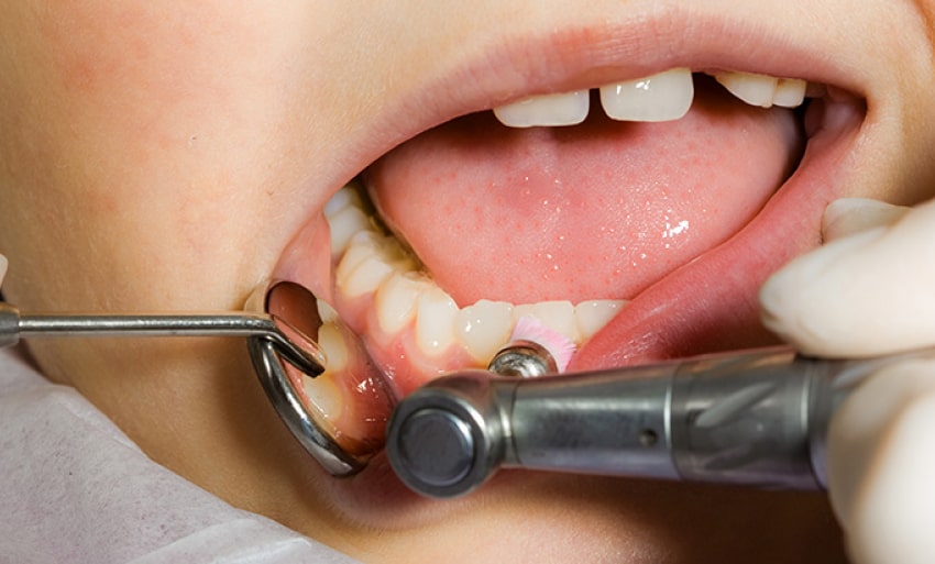Профилактика odent dentist warszawa