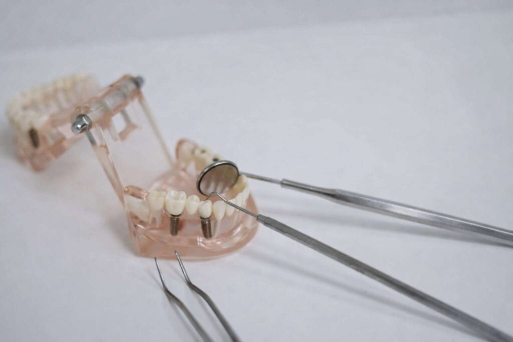 Jakie błędne przekonania o implantach najczęściej powtarzają pacjenci