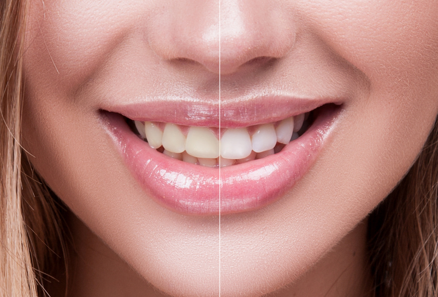 odent cosmetic dentistry