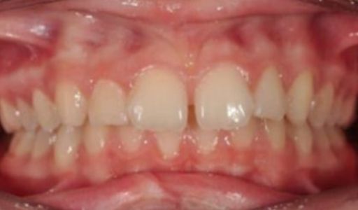 Effects of treatment Orthodontics