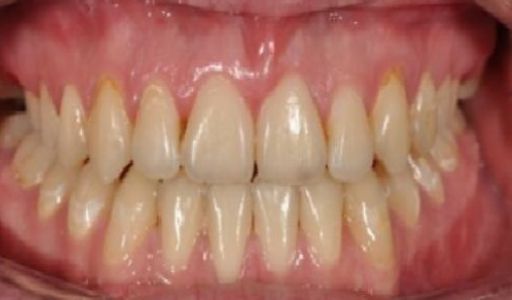 Effects of treatment Orthodontics